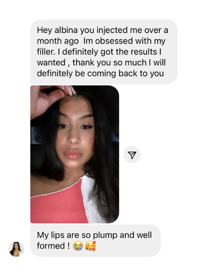 Lip Before & After Treatment Client reviews In Brooklyn, NY & Aventura, FL | Beauty Injector NYC