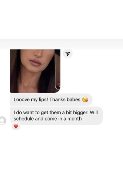 Lip Treatment Client Reviews In Brooklyn, NY & Aventura, FL | Beauty Injector NYC