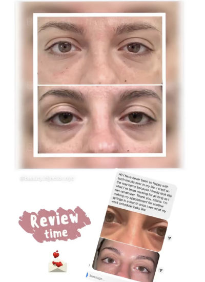 Lip Treatment client reviews In Brooklyn, NY & Aventura, FL | Beauty Injector NYC