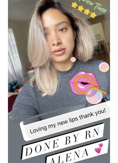 Lip Treatment client reviews In Brooklyn, NY & Aventura, FL | Beauty Injector NYC